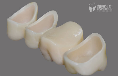 全瓷牙与全锆牙的相同点与不同点